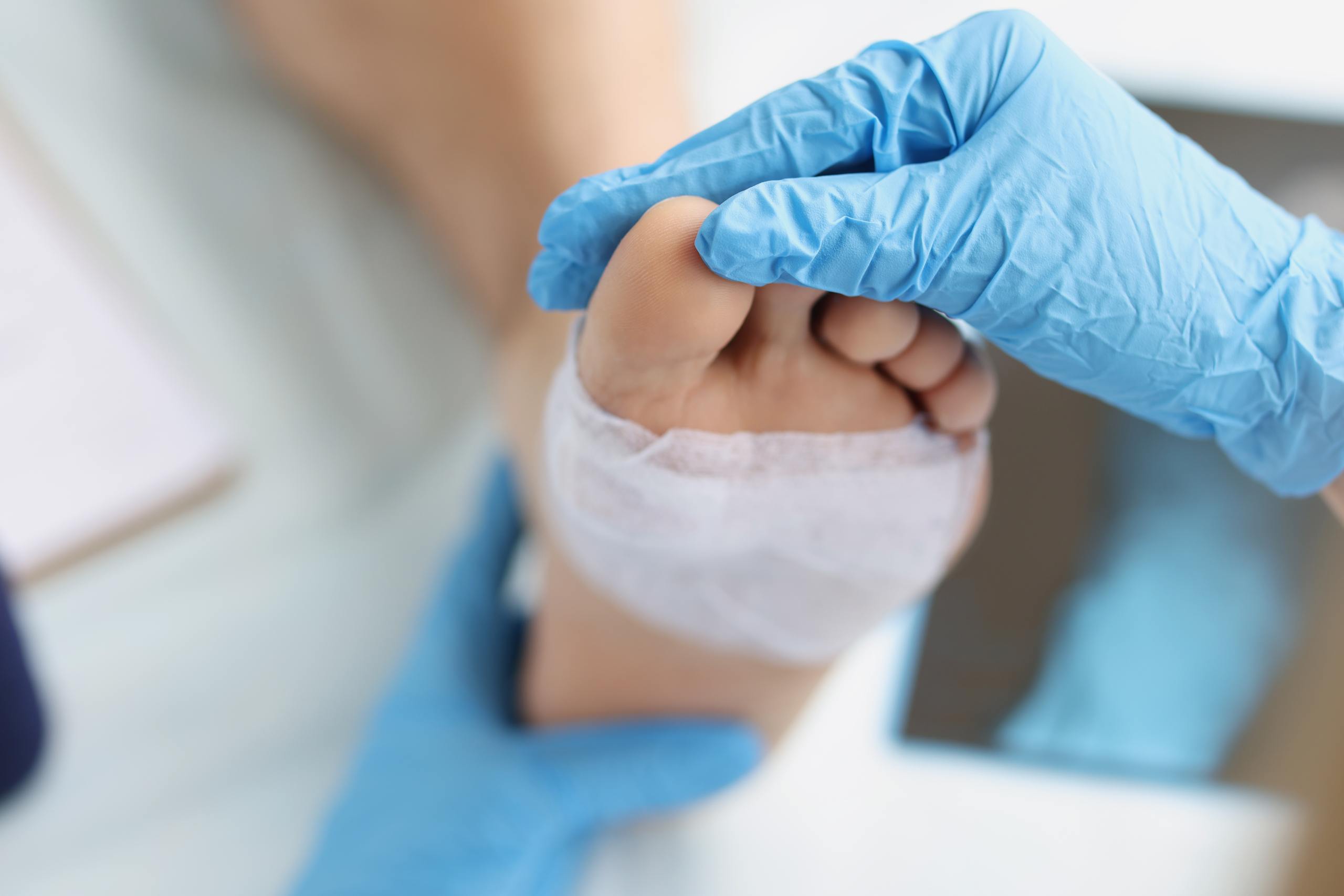 CGS Reconsiders Local Coverage Determination on Skin Substitutes