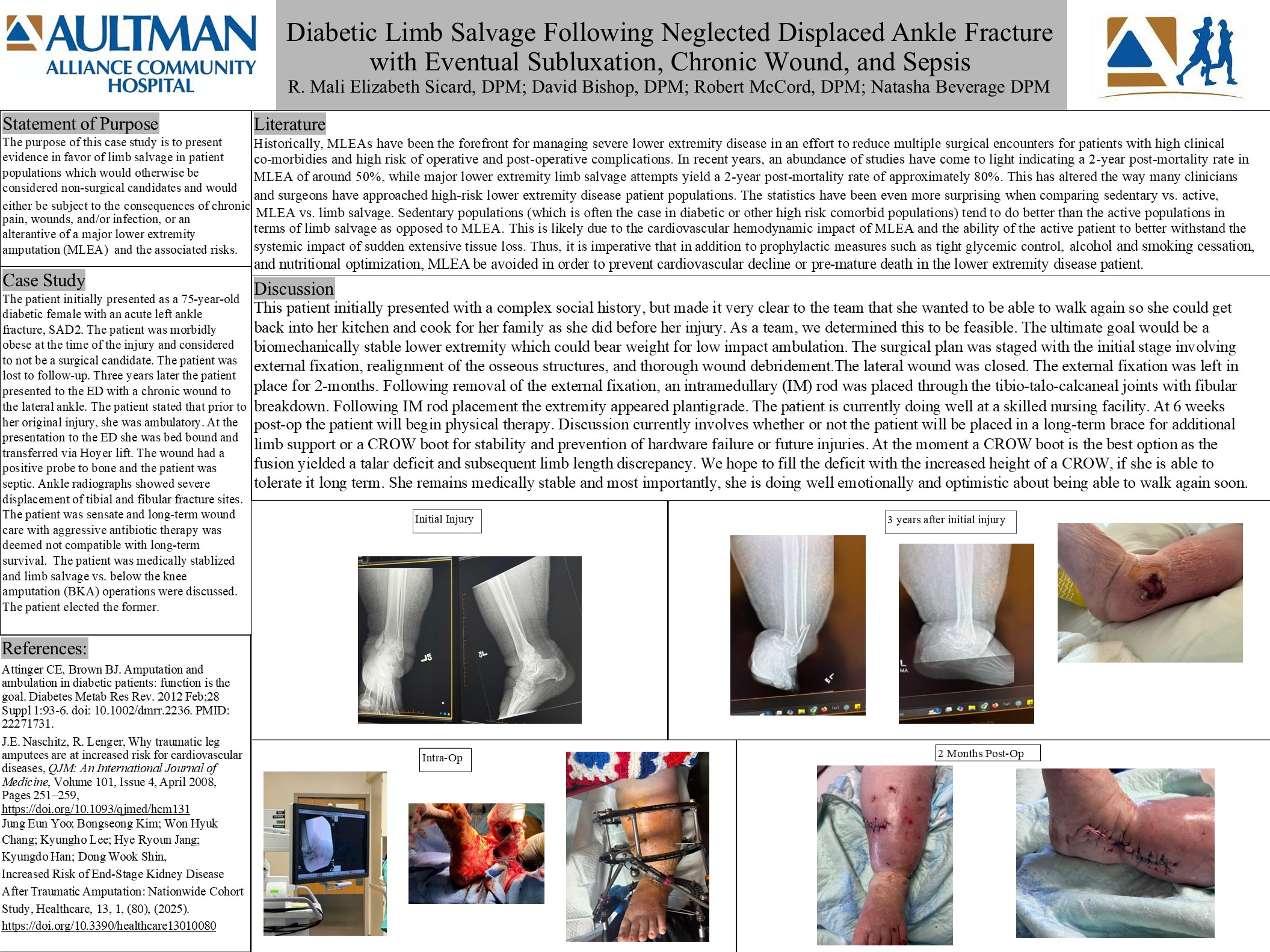 Diabetic Limb Salvage Following Neglected Displaced Ankle Fracture With Eventual Subluxation, Chronic Wound, and Sepsis