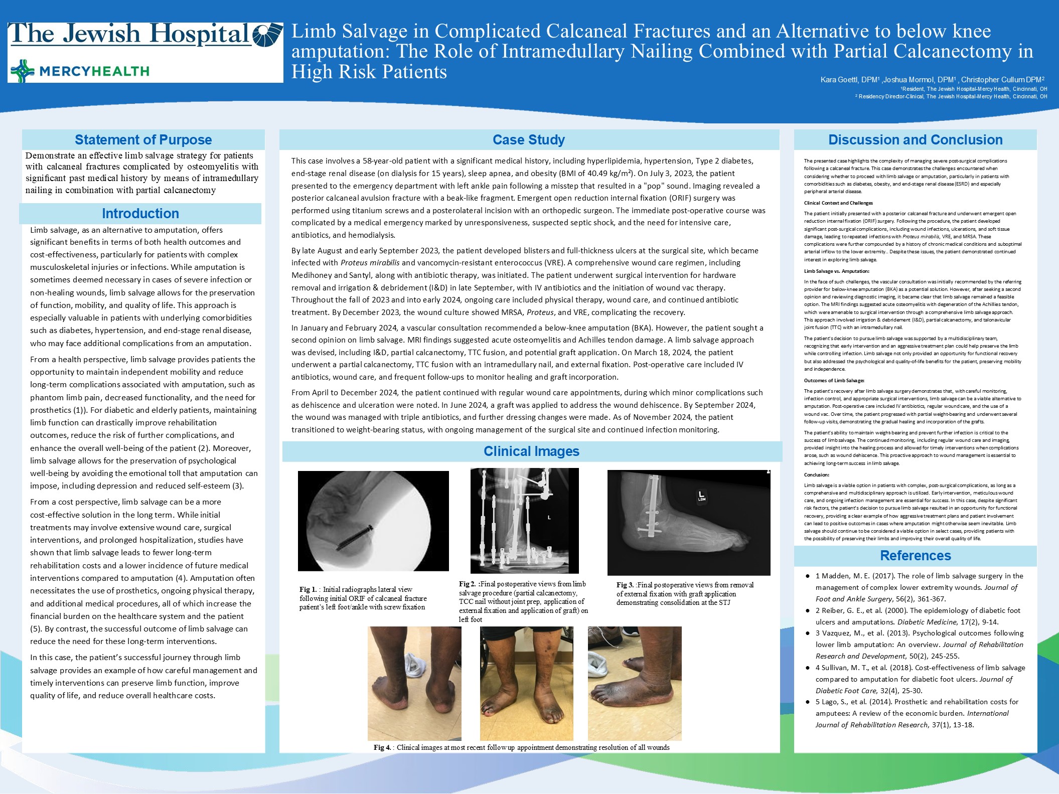 Limb Salvage in Complicated Calcaneal Fractures as an Alternative to Below Knee Amputation: The Role of Intramedullary Nailing Combined With Partial Calcanectomy in High Risk Patients 